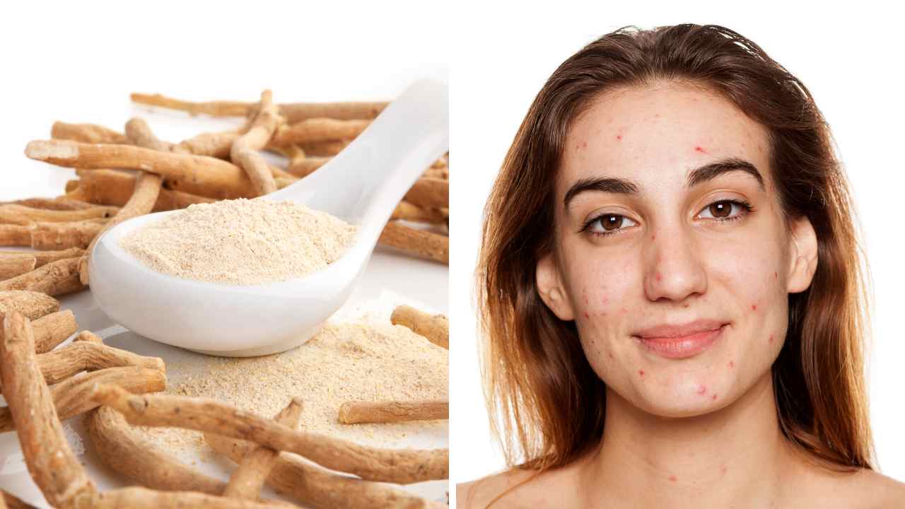 Debunking the Myth: Can Ashwagandha Cause Acne?